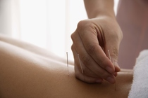 Acupuncture Treatment for Integral Ballet Fundraiser